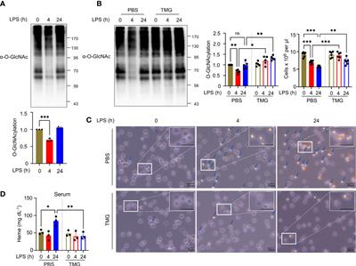 O-GlcNAcylation of RIPK1 rescues red blood cells from necroptosis